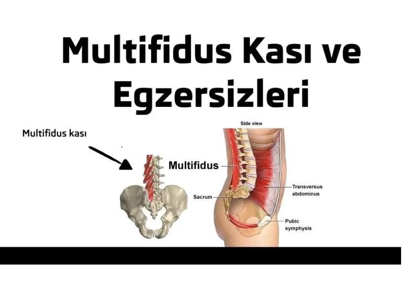 Multifidus Kası ve Egzersizleri